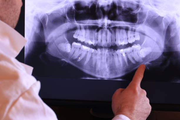 Best Knocked-Out Tooth Emergency  in Bloomingdale, IL