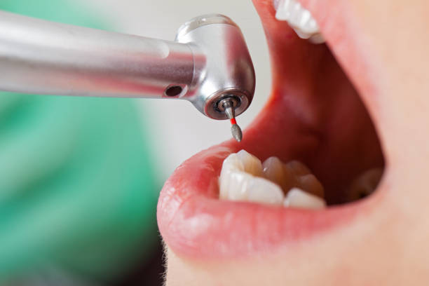 Best Emergency Tooth Extraction  in Bloomingdale, IL